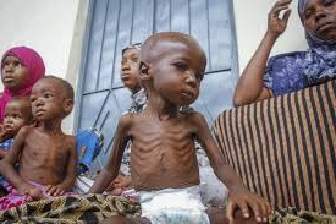 Child malnutrition